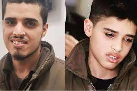 The right is before his arrest. The after is when he was released